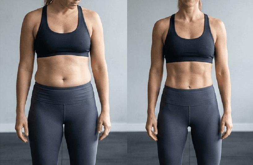 Antes e depois de paciente mulher, vista frontal